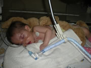 Leah Marx Trust Fund, The first time I saw her I was overwhelmed with love for her. Perfect in every way, ten toes en ten fingers, or so we thought... After holding her for 20min she was taken away to NNICU, she was not getting enough oxygen and turned a little blue. Leah was kept in NNICU (Neo Natal Intensive Care Unit) for about 10 days on oxygen and tube feeding. She was sent home but was back in hospital after a week. She wasn't eating well and therefore not picking up any weight. Another week in hospital and we were back home, Any donations welcome, Donate, Help a child, Pretoria, Gauteng