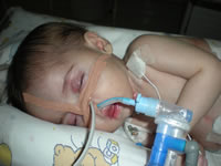 Leah Marx Trust Fund, The first time I saw her I was overwhelmed with love for her. Perfect in every way, ten toes en ten fingers, or so we thought... After holding her for 20min she was taken away to NNICU, she was not getting enough oxygen and turned a little blue. Leah was kept in NNICU (Neo Natal Intensive Care Unit) for about 10 days on oxygen and tube feeding. She was sent home but was back in hospital after a week. She wasn't eating well and therefore not picking up any weight. Another week in hospital and we were back home, Any donations welcome, Donate, Help a child, Pretoria, Gauteng